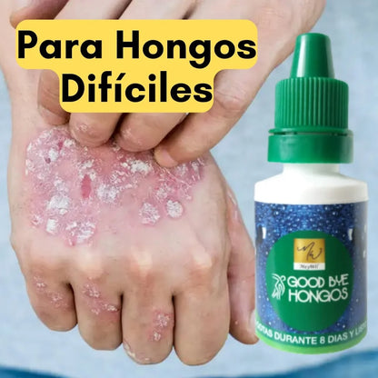 NOGADERM™ Crema Para Hongos de Pies