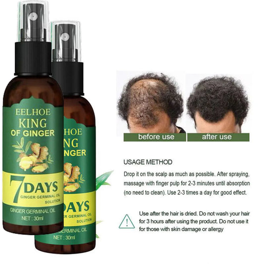 EELHOE King Of Ginger® Spray Tónico Capilar para Crecimiento en 7 días (1 tratamiento)